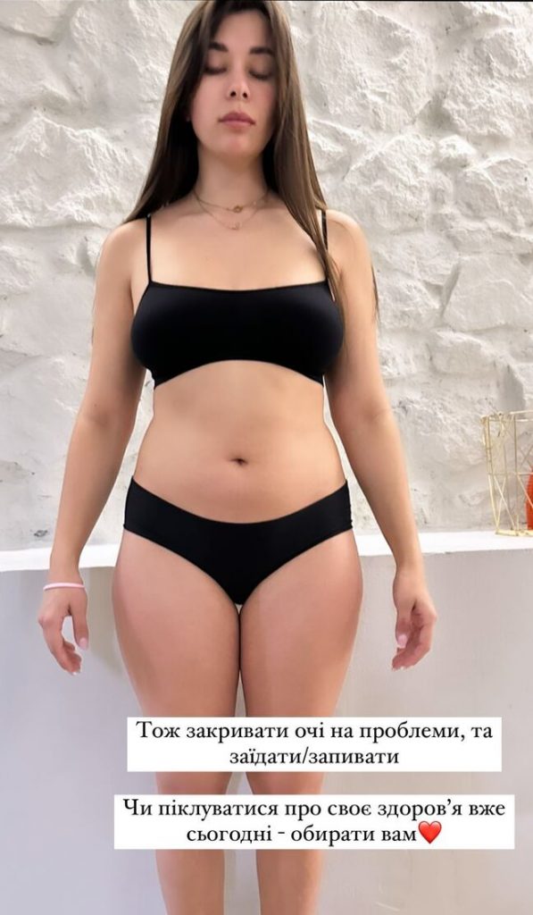 Мінус 12 кг: Анна Неплях вразила світлинами до та після схуднення