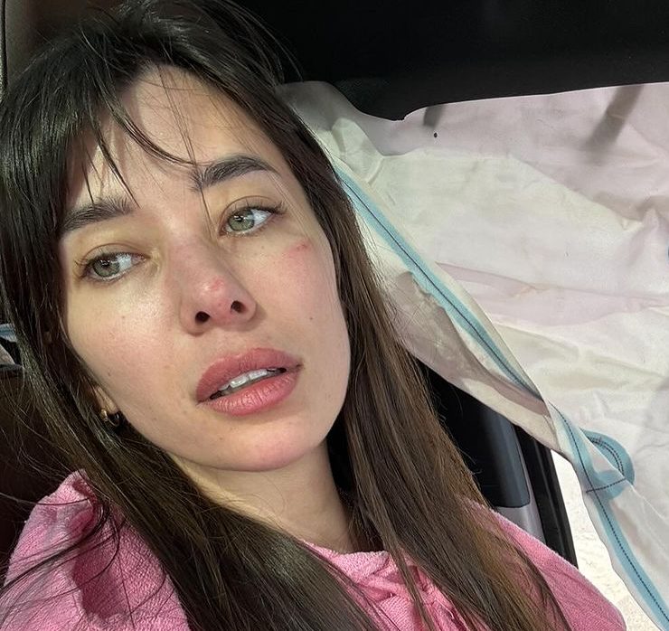 «Я жива»: Анна Неплях потрапила в автотрощу