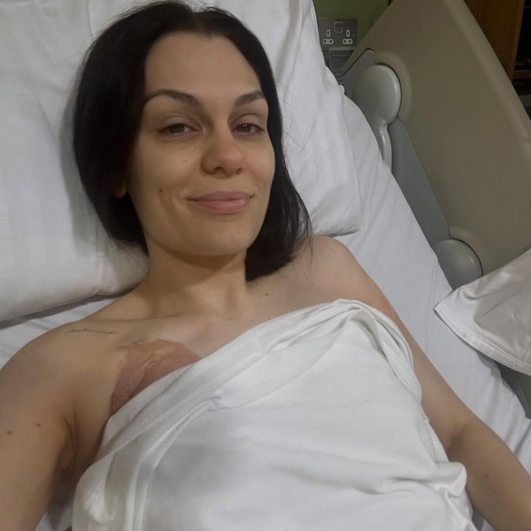 «Мені сумно»: Джессі Джей перенесла мастектомію