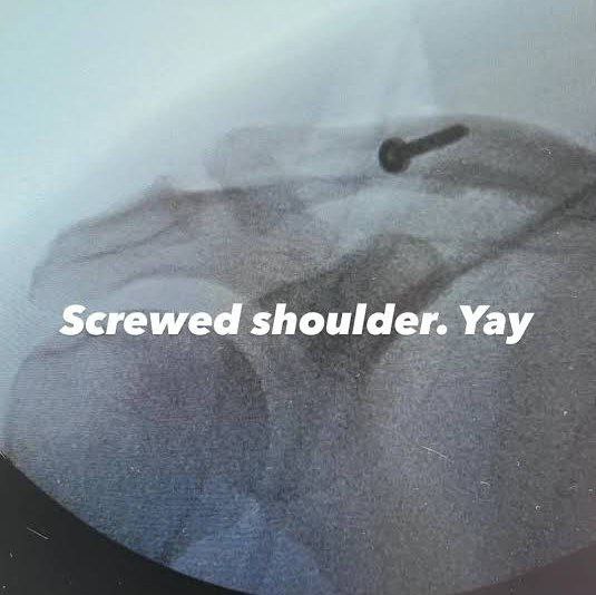 Ченнинг Татум перенес срочную операцию